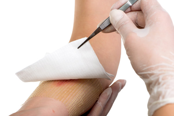 Tissue Viability - Assessment and Treatment of Wound